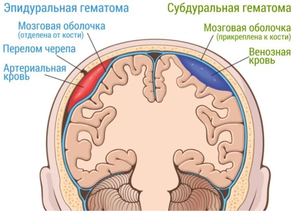 Каких призывников с сотрясением мозга могут отправить служить